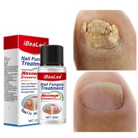 Thickening Of Special Bacteriostatic Liquid For Onychomycosis